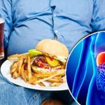 How-To-Cure-Fatty-Liver